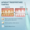 1+1 GRATIS Dispozitiv electric pentru indepartarea depunerilor de tartru, Turcoaz