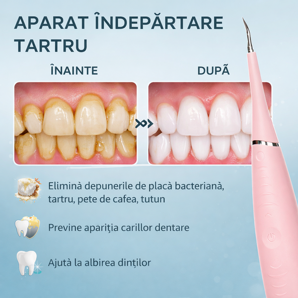 1+1 GRATIS Dispozitiv electric pentru indepartarea depunerilor de tartru, Roz